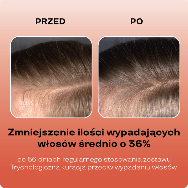Stymulujące serum przeciw wypadaniu włosów, 5% kompleksu peptydów egzosomowych, 1% adenozyny, biotynylowany peptyd, kopexil